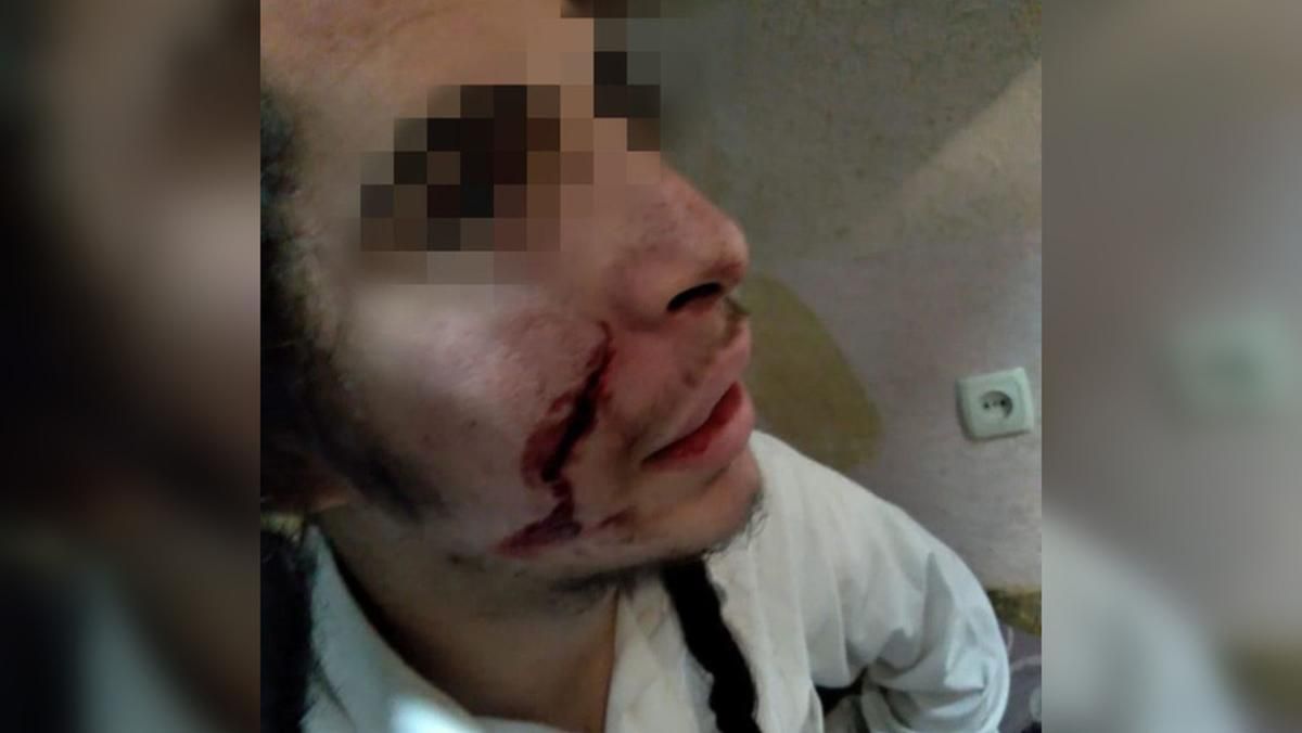 В Умані невідомі ножем поранили підлітка з Ізраїлю В Умані невідомі ножем поранили підлітка з Ізраїлю