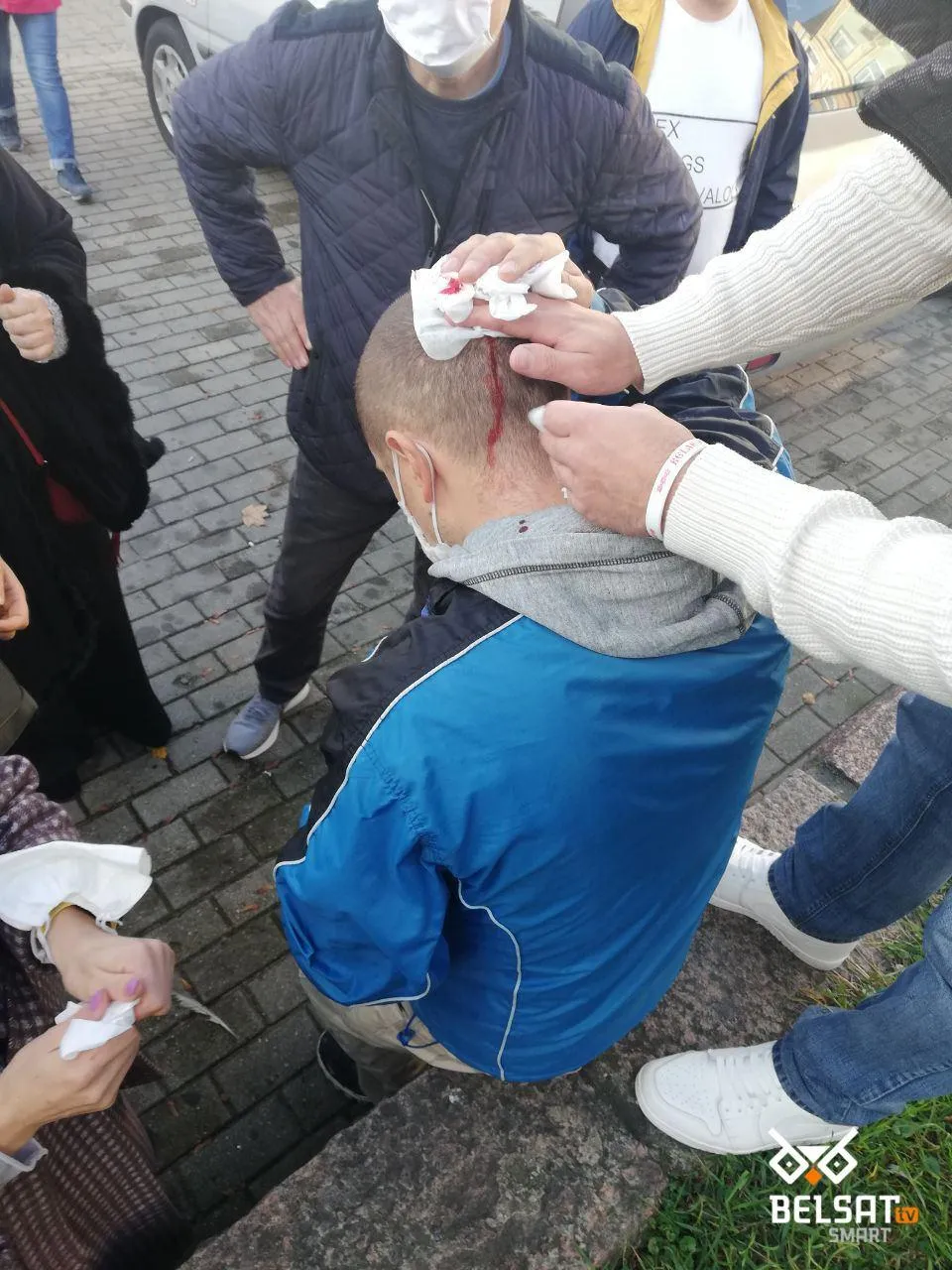 перший поранений під час протестів у Гродно