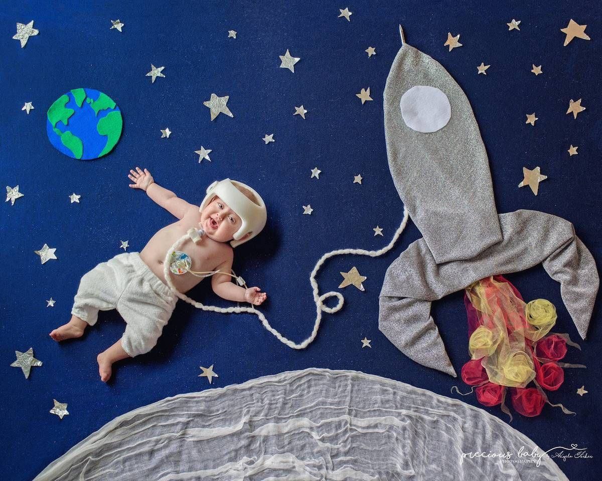 The Precious Baby Project: фото детей с серьезными заболеваниями