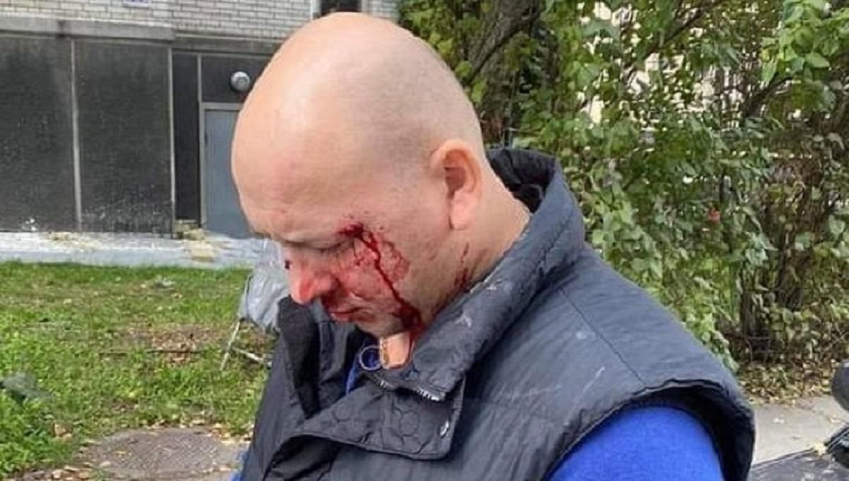 Избиение Ивана Деева в Киеве: что известно о напавших на ветерана АТО