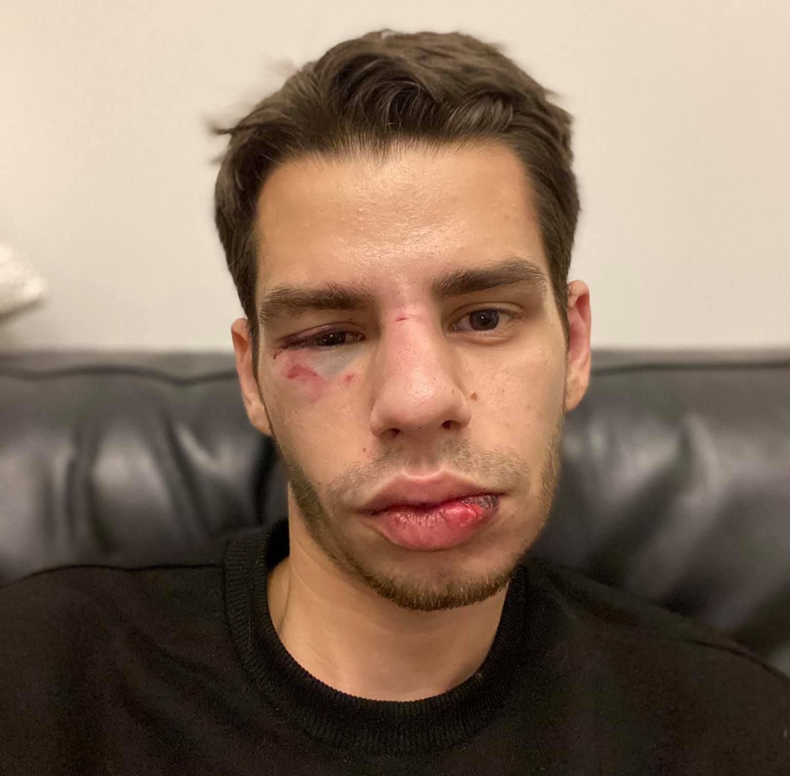 Ехал с собакой домой: во Львове водитель Bolt жестоко избил парня: фото Ехал с собакой домой: во Львове водитель Bolt жестоко избил парня: фото