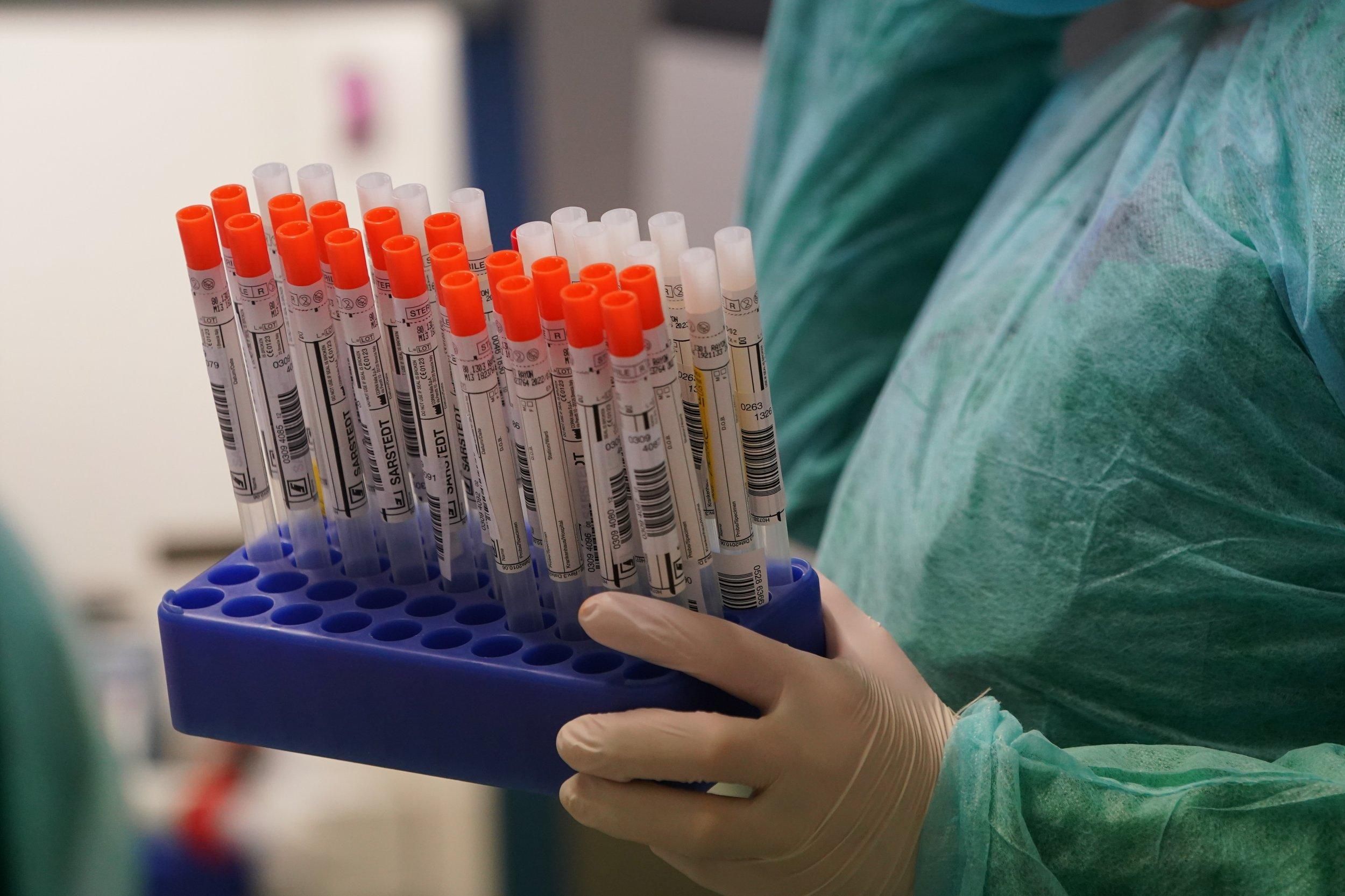 Где во Львове делают бесплатный тест на коронавирус: адреса лабораторий