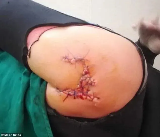 напад акули в Єгипті напад акули в Єгипті