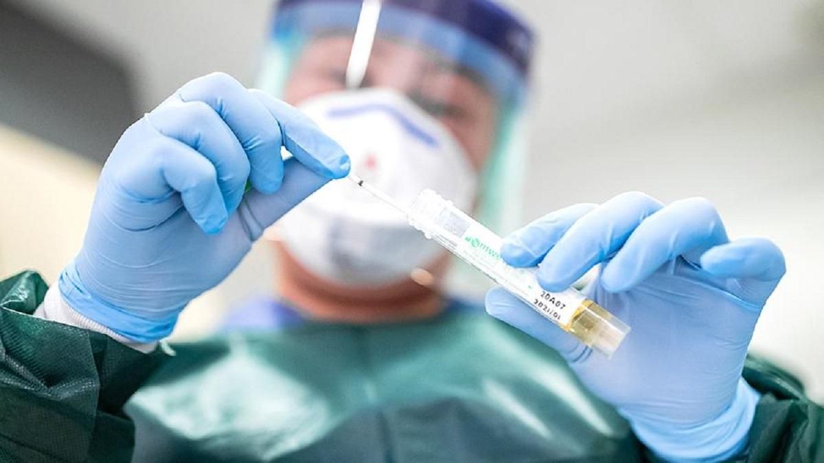 Смертність від COVID-19 "помолодшала": інфекціоністи назвали такі дані небезпечними