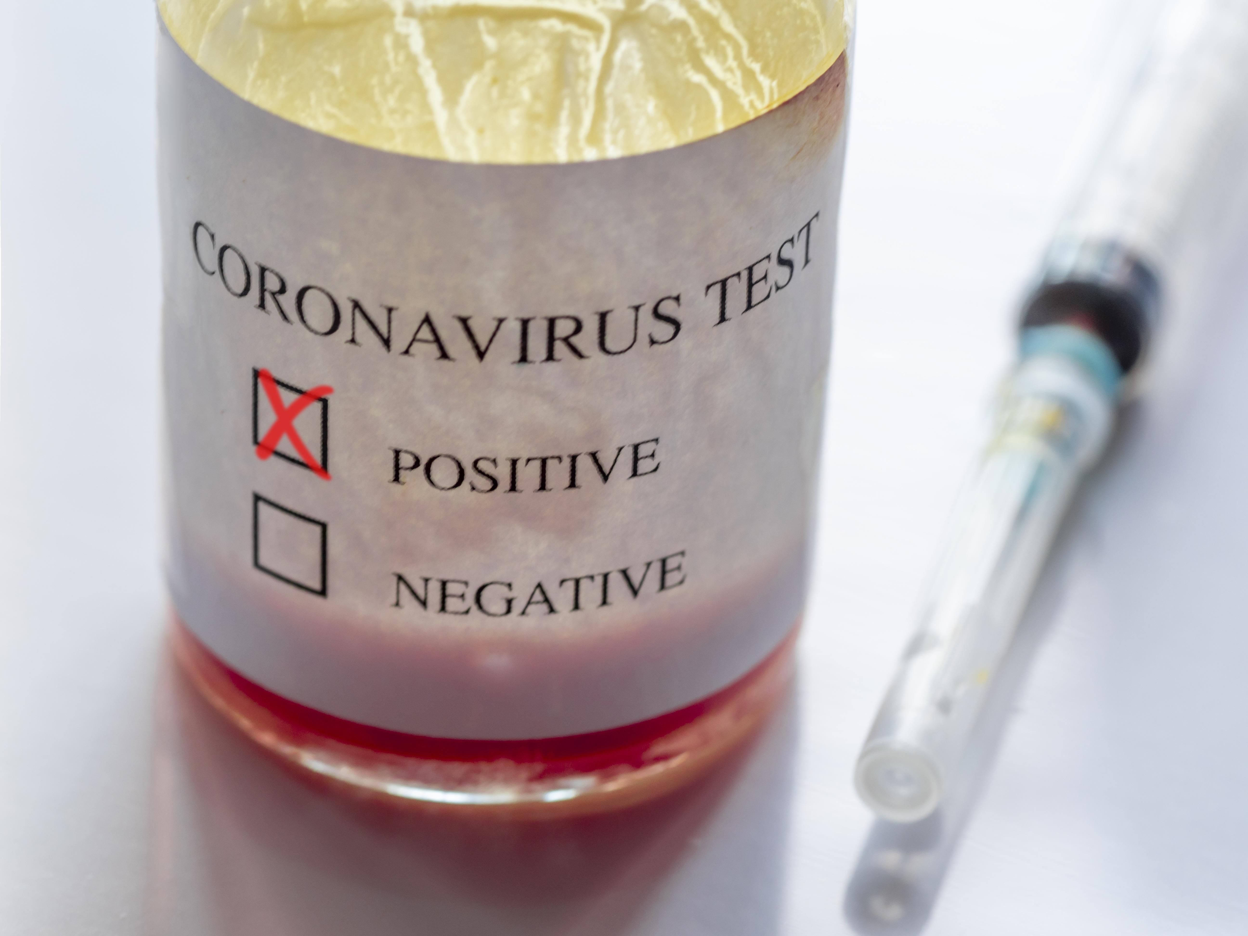 Ситуація з коронавірусом в ОРДЛО критично погіршується
