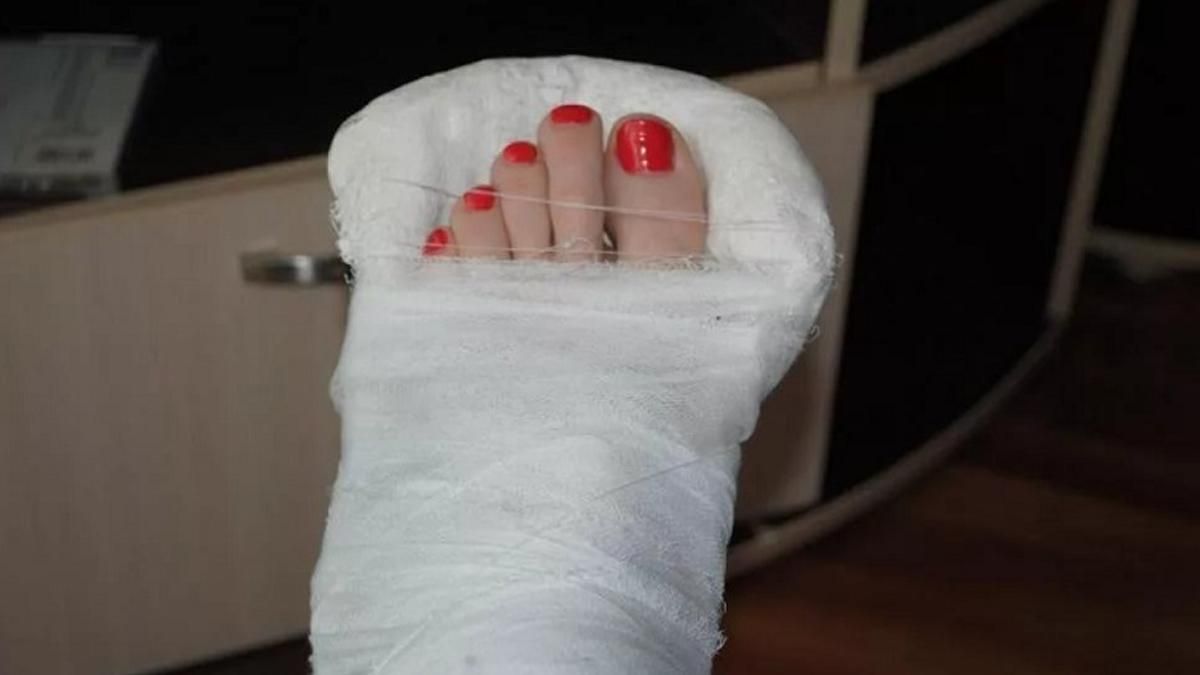 Через ожеледицю у Києві фіксують масові звернення у травмпункти Через ожеледицю у Києві фіксують масові звернення у травмпункти