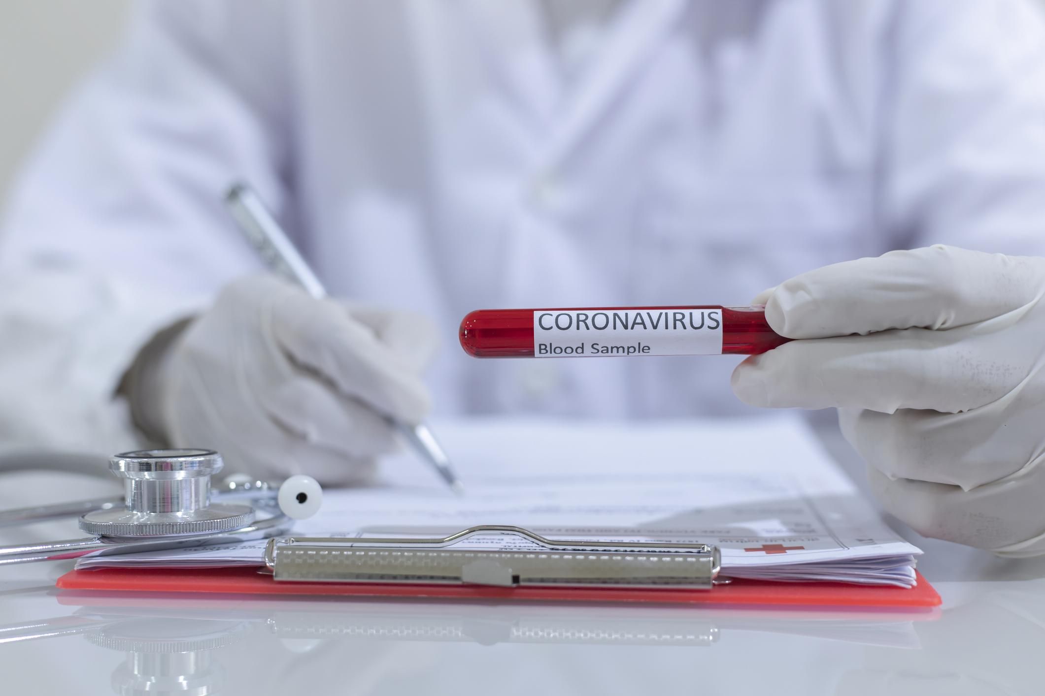 МОЗ оновило алгоритм тестування на COVID-19: сімейні лікарі зможуть проводити тест