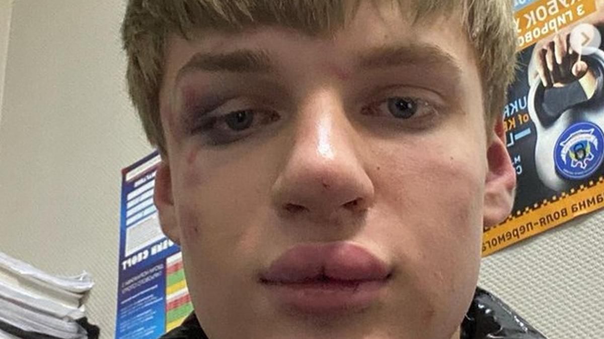 У Києві гомофоби влаштували облаву на хлопця через нафарбовані губи У Києві гомофоби влаштували облаву на хлопця через нафарбовані губи