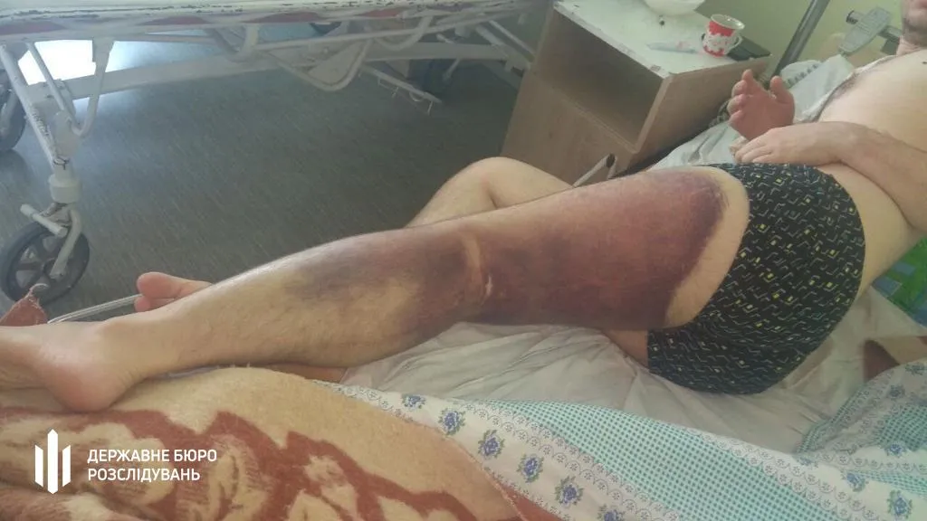 Тортури поліції на Миколаївщині Тортури поліції на Миколаївщині