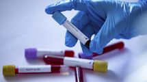 В Украине за минувшие сутки не исследовали более 700 COVID-тестов: где именно В Украине за минувшие сутки не исследовали более 700 COVID-тестов: где именно