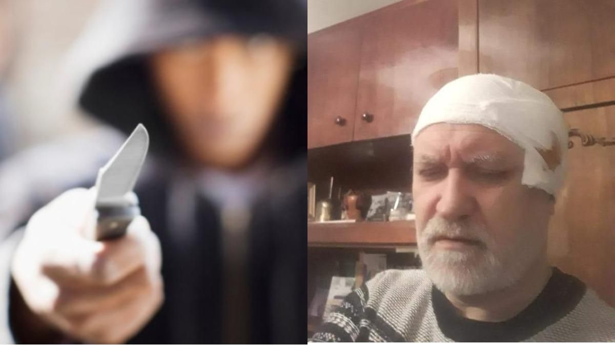 В Запорожье с ножом напали на двух священников УПЦ МП В Запорожье с ножом напали на двух священников УПЦ МП