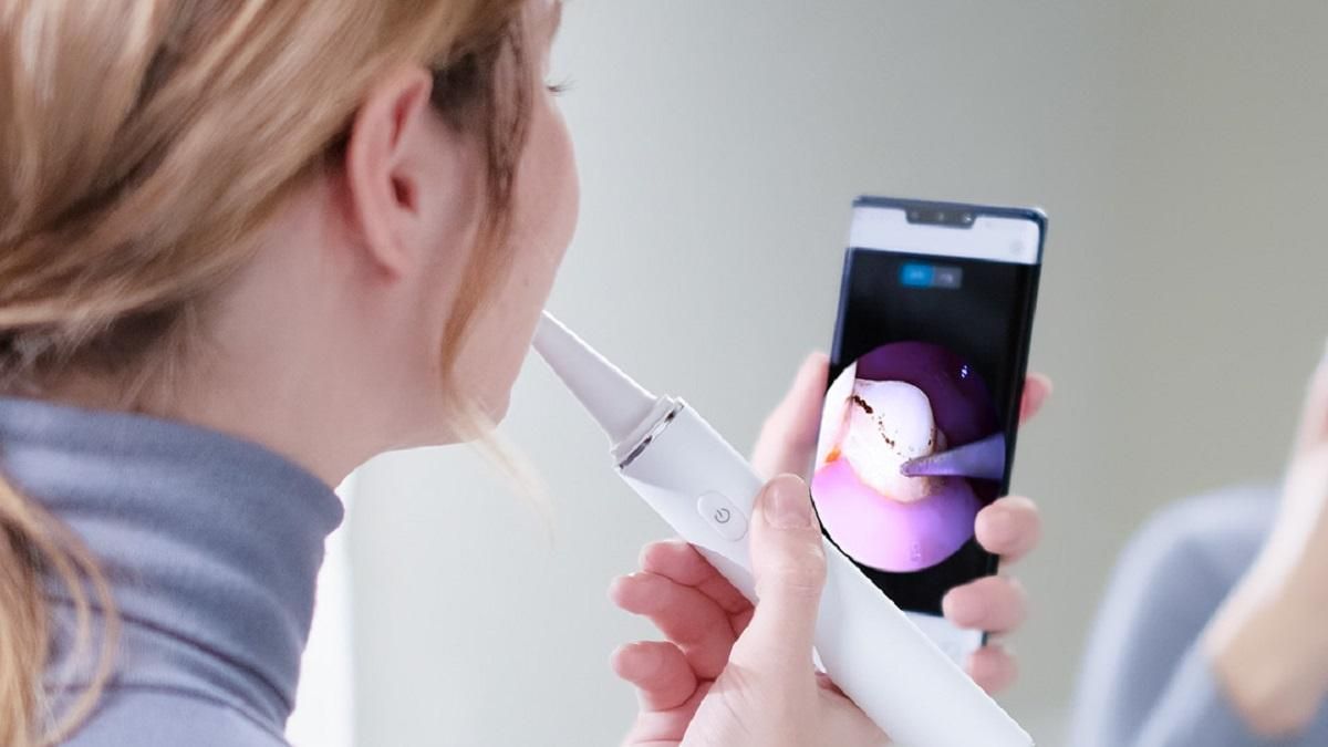 Xiaomi Sunuo T11 Pro: домашній скалер для видалення зубного нальоту