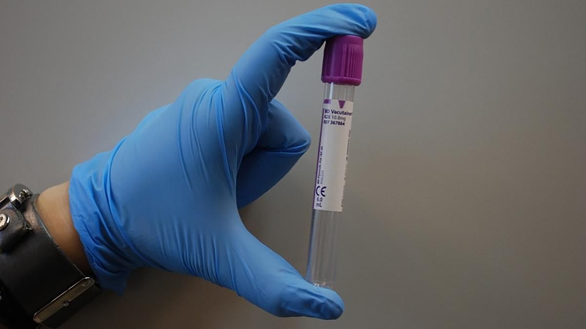 Отруйники Навального з НДІ-2 ФСБ: група Bellingcat оприлюднила розслідування про смерть ще щонайменше 3 людей Отруйники Навального з НДІ-2 ФСБ: група Bellingcat оприлюднила розслідування про смерть ще щонайменше 3 людей