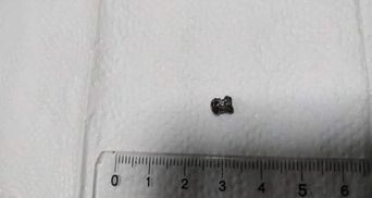 Необычный аппендицит: во Львове прооперировали мальчика, который проглотил пулю – фото