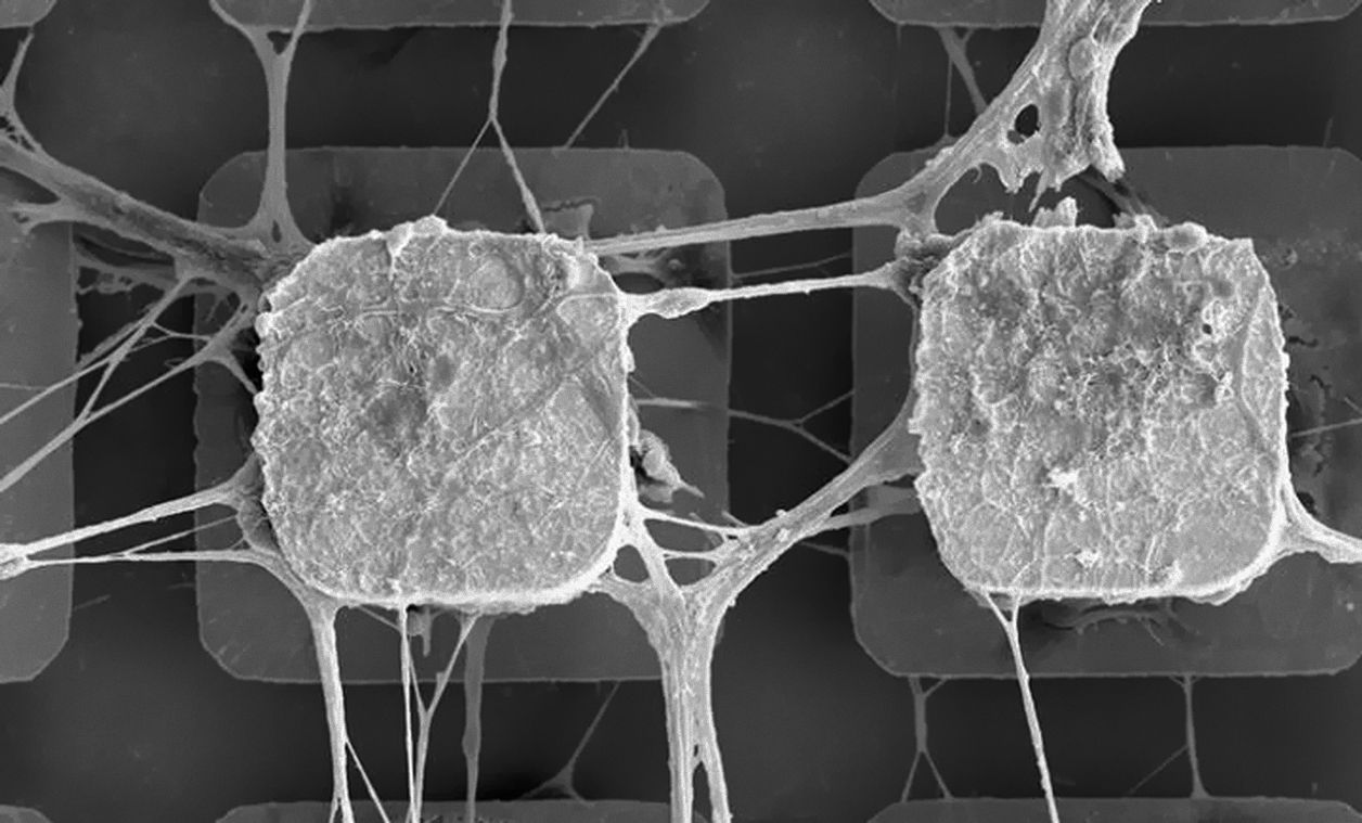 Вчені вмонтували живі нейрони в комп'ютерні мікрочіпи Вчені вмонтували живі нейрони в комп'ютерні мікрочіпи