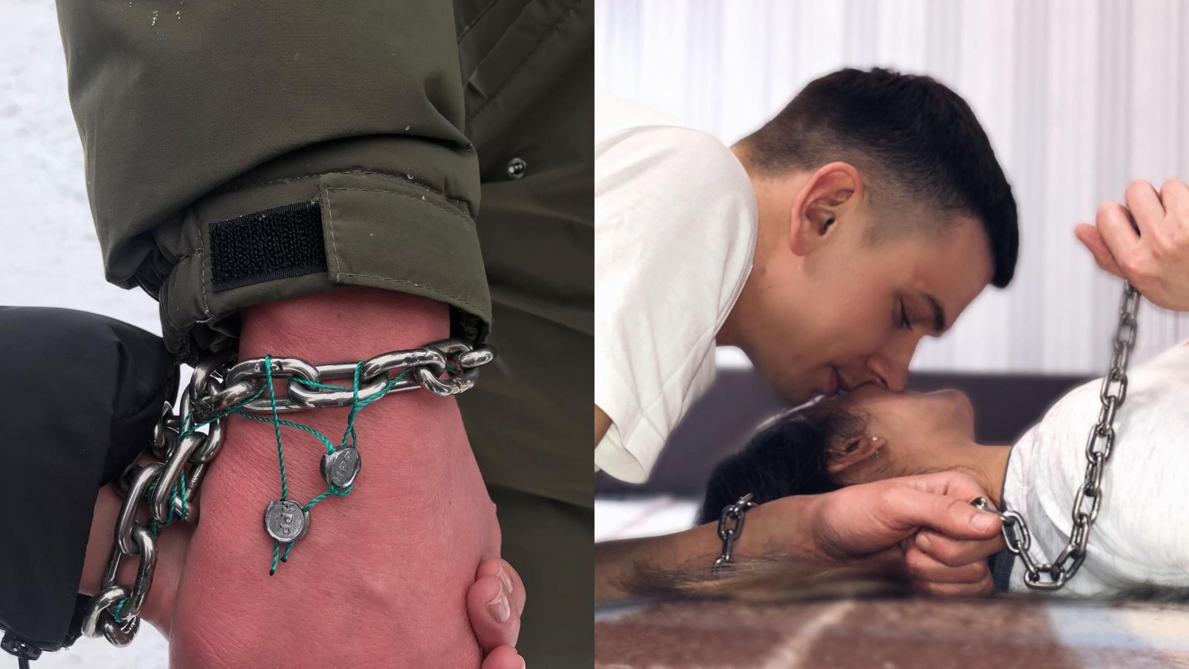 Розпухли руки і залишилися опіки: пара скувала кисті ланцюгом Розпухли руки і залишилися опіки: пара скувала кисті ланцюгом