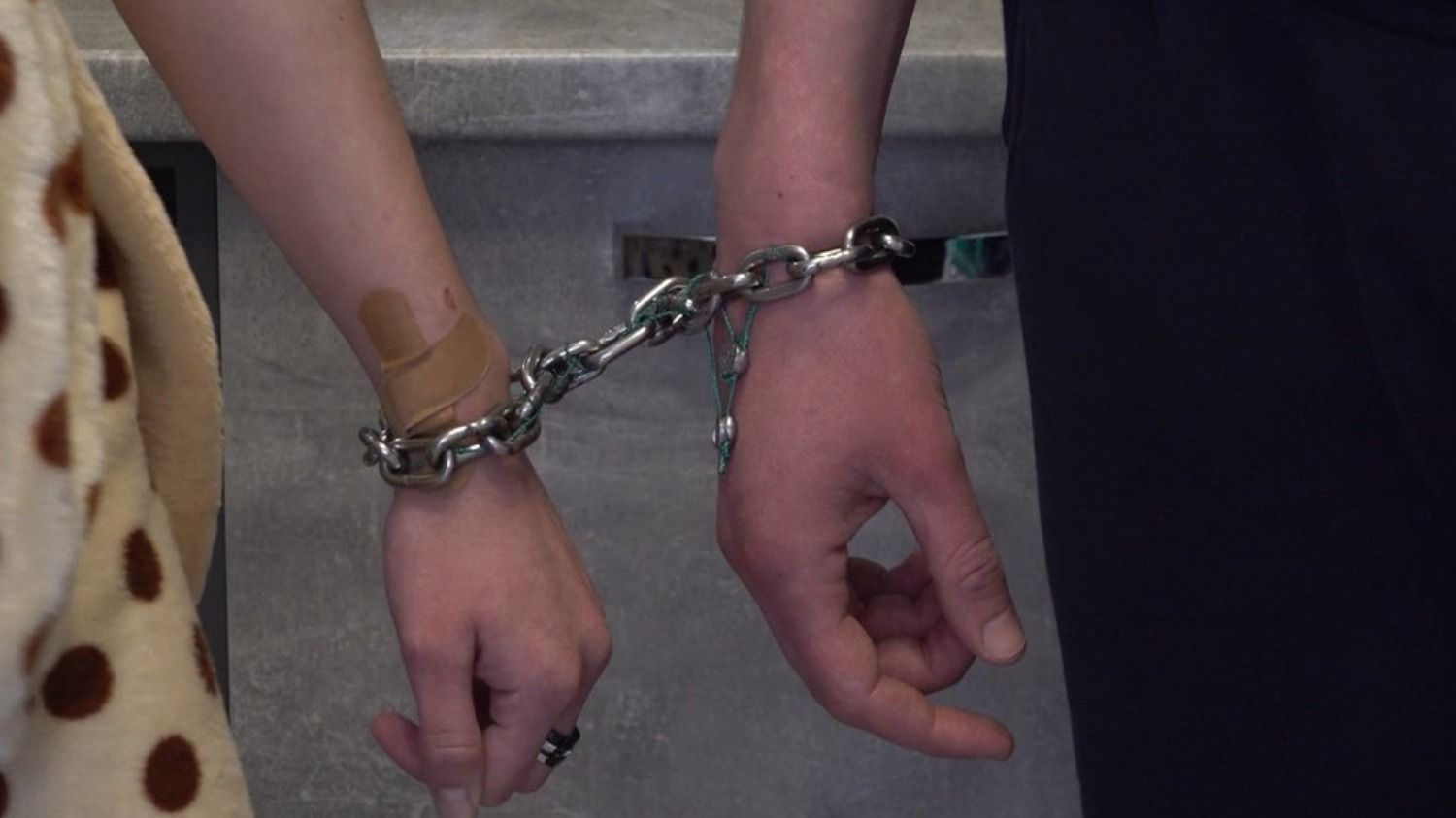 Ужасные раны на руке: в скованной цепью пары проблемы со здоровьем Ужасные раны на руке: в скованной цепью пары проблемы со здоровьем