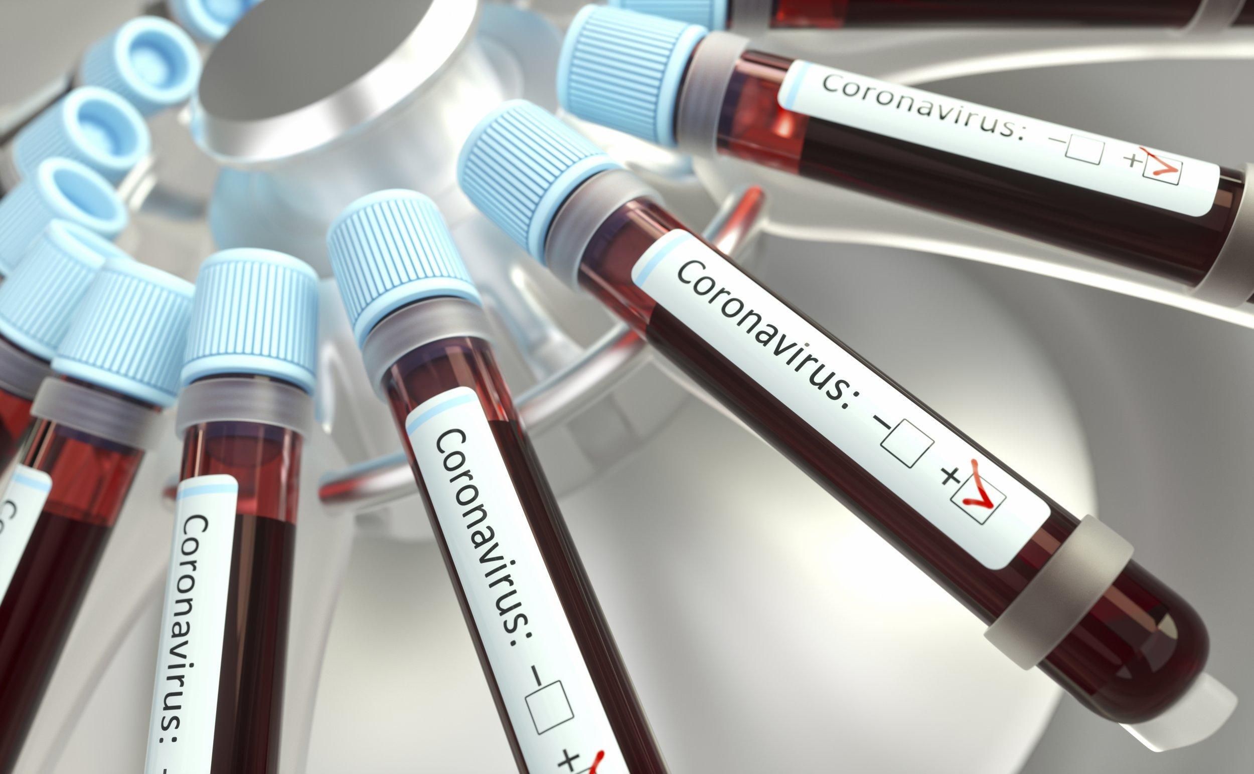 Ситуация - тревожная: во Львовской значительно выросла заболеваемость COVID-19 Ситуация - тревожная: во Львовской значительно выросла заболеваемость COVID-19