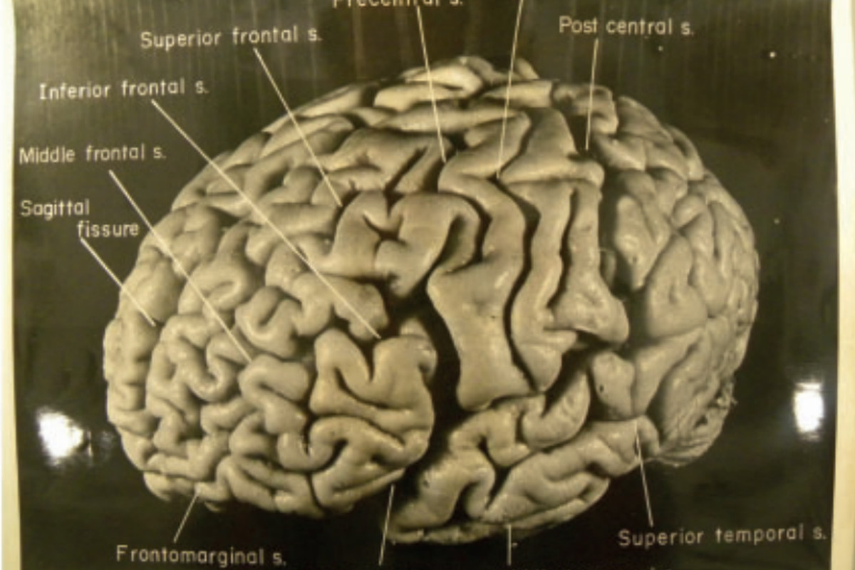 мозок альберта ейнштейна