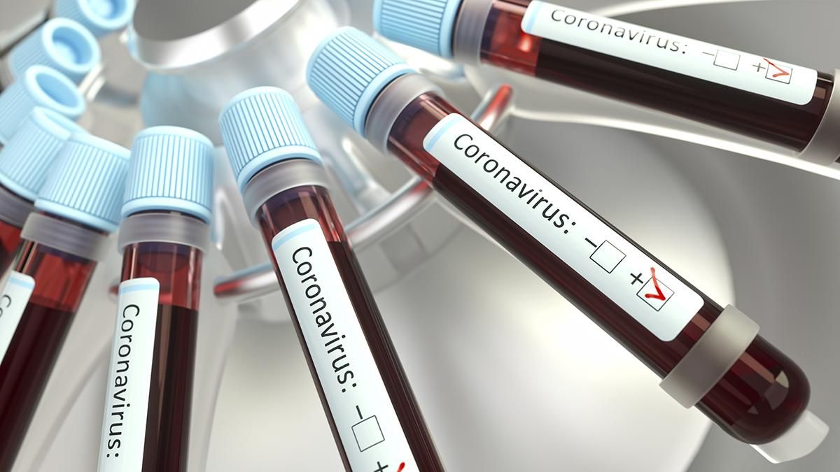 На Одещині зростає захворюваність на коронавірус: статистика COVID-19