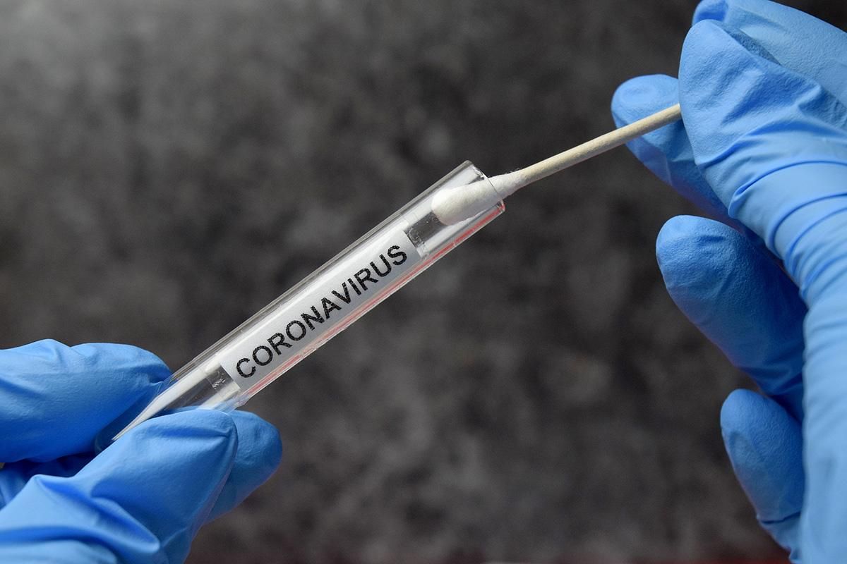 Надлишкова смертність від COVID-19 в Україні має максимальні показники