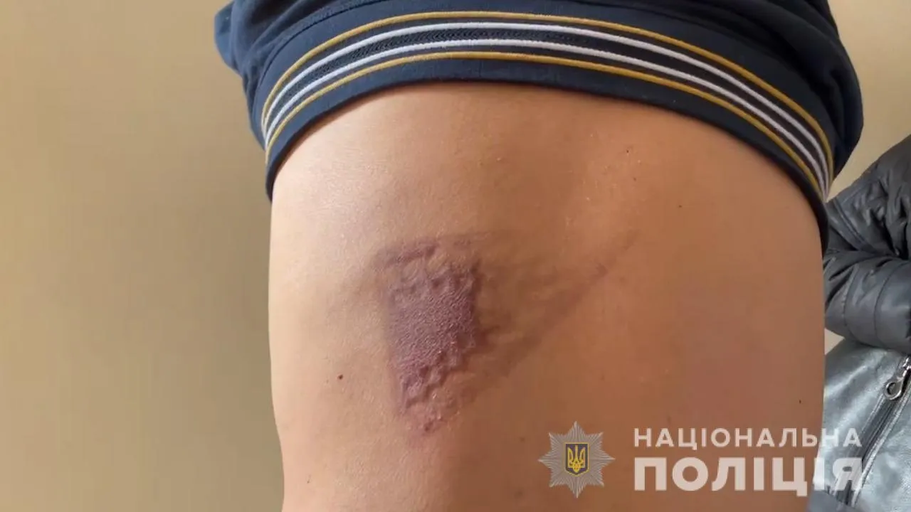 зловмисники катували заручників зловмисники катували заручників