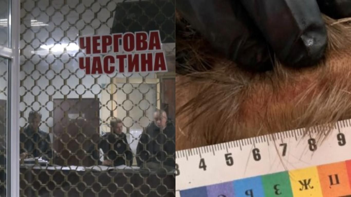 Били залізним стільцем: моторошна розправа поліції над чоловіком Били залізним стільцем: моторошна розправа поліції над чоловіком