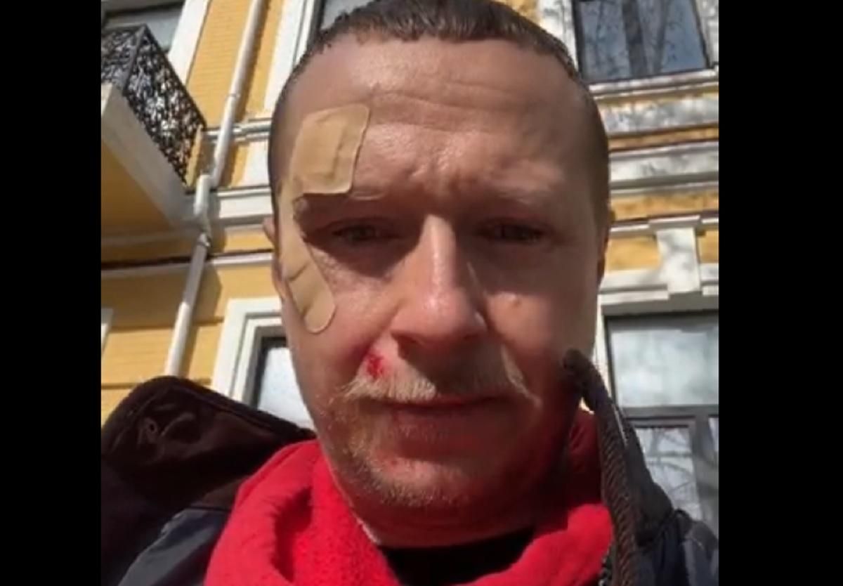 Розпилили газ в очі та вдарили: сутичка Щура з 2 хлопцями Розпилили газ в очі та вдарили: сутичка Щура з 2 хлопцями