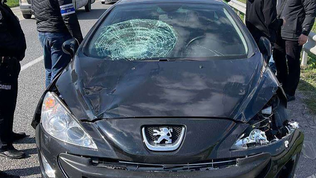 Парню удалили часть черепа, девочка – в коме: последствия ДТП под Днепром с водителем Peugeot Парню удалили часть черепа, девочка – в коме: последствия ДТП под Днепром с водителем Peugeot