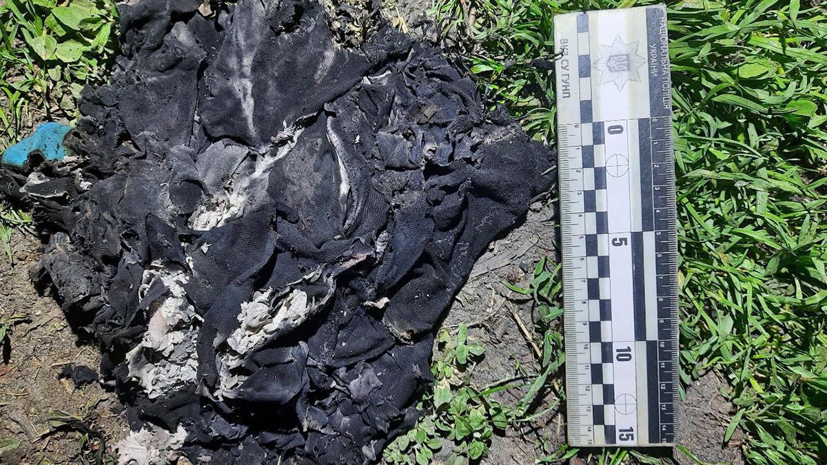 На Одещині чоловік підпалив сусідку: вона у важкому стані На Одещині чоловік підпалив сусідку: вона у важкому стані