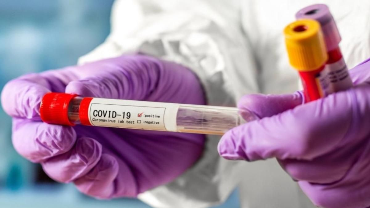 В Киеве за сутки от COVID-19 умерли 26 человек - Киев В Киеве за сутки от COVID-19 умерли 26 человек - Киев