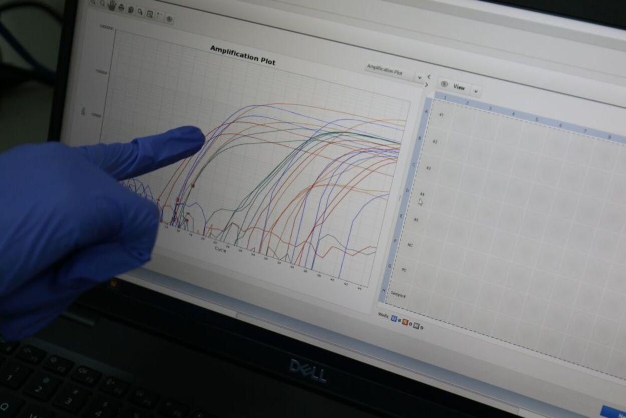 Коронавірус у Львові та області: скільки нових хворих та яка ситуація у лікарнях Коронавірус у Львові та області: скільки нових хворих та яка ситуація у лікарнях