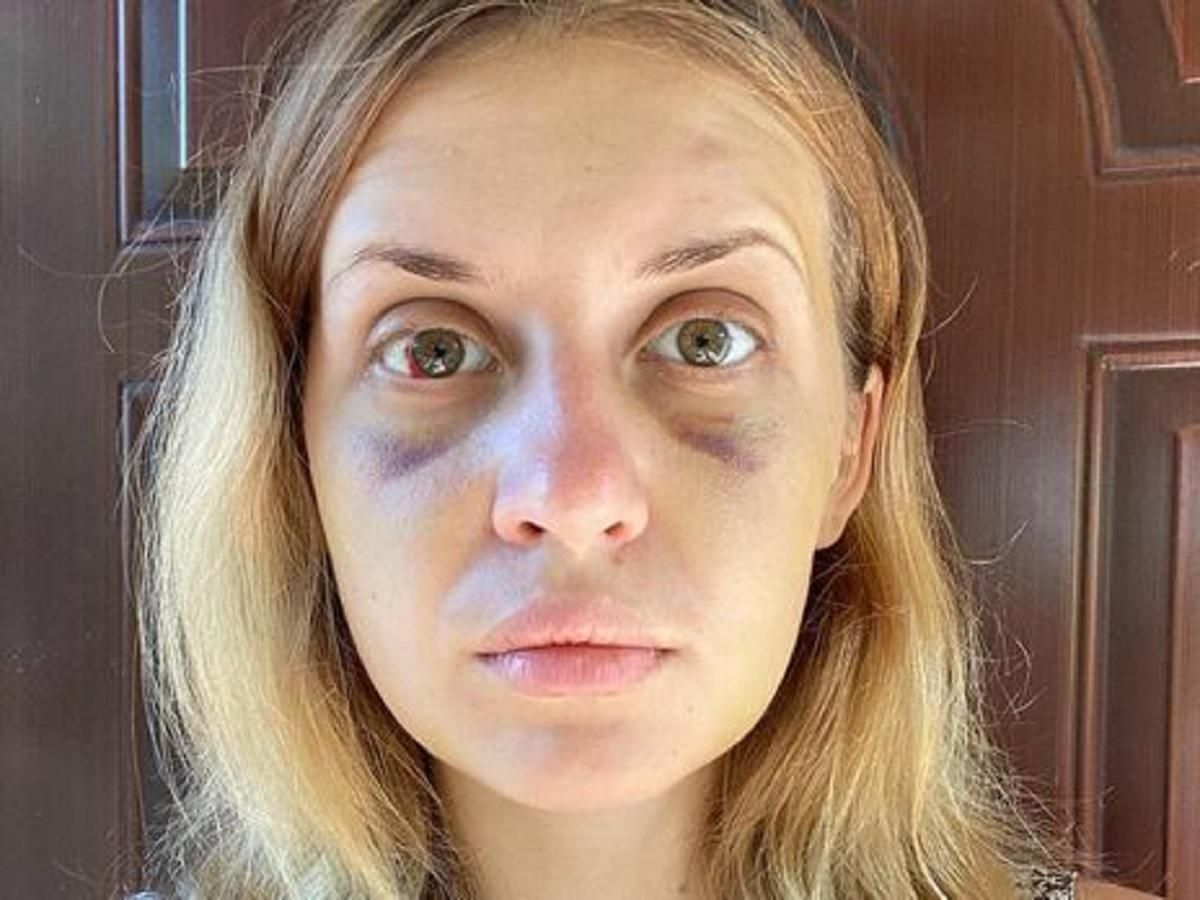 Спроба згвалтування Лугової: суд закрив кримінальне провадження Спроба згвалтування Лугової: суд закрив кримінальне провадження