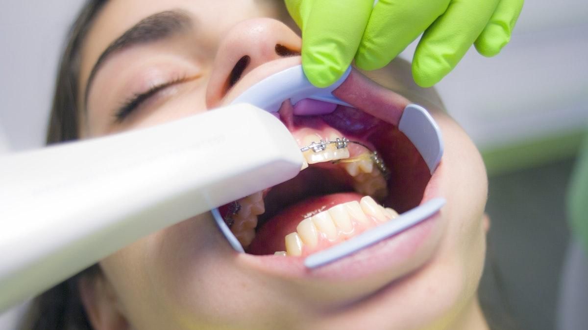 Стоматологи видалили дитині 12 молочних зубів начебто без згоди матері