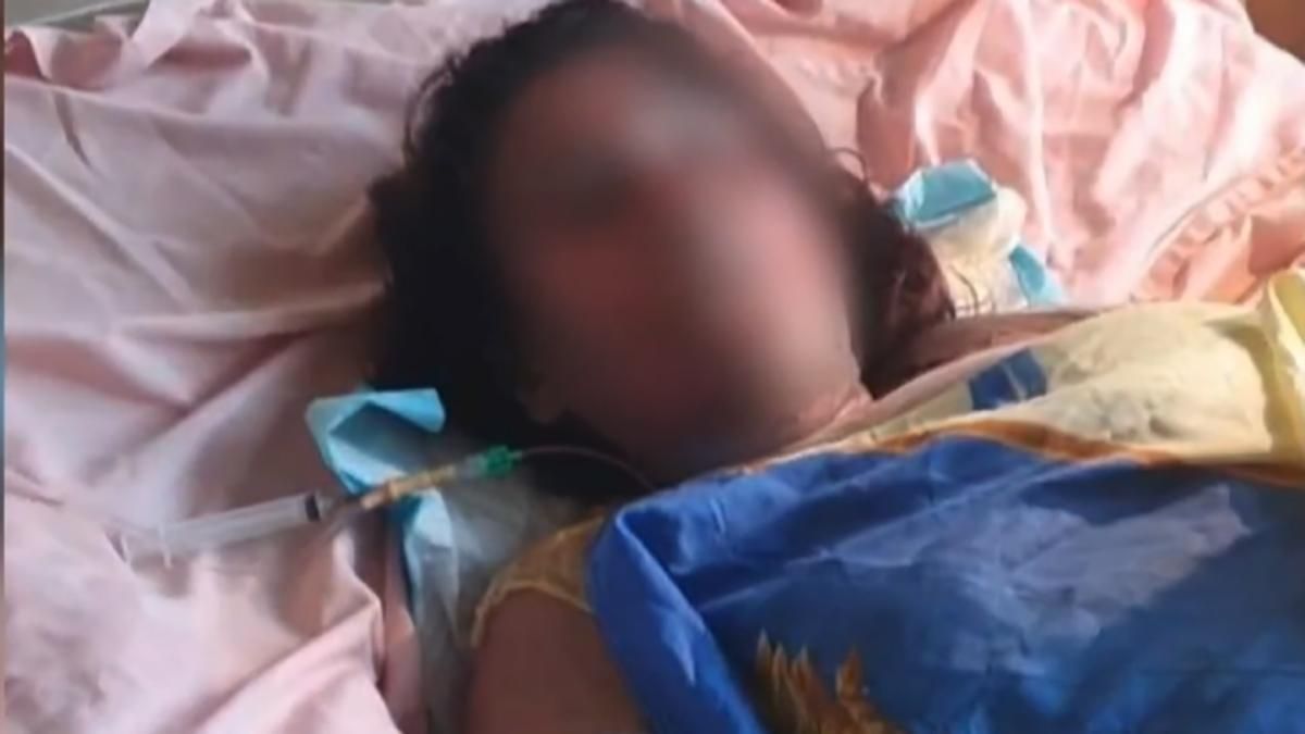 Який стан дівчини, яку підпалив 17-річний співмешканець у Кривому розі Який стан дівчини, яку підпалив 17-річний співмешканець у Кривому розі