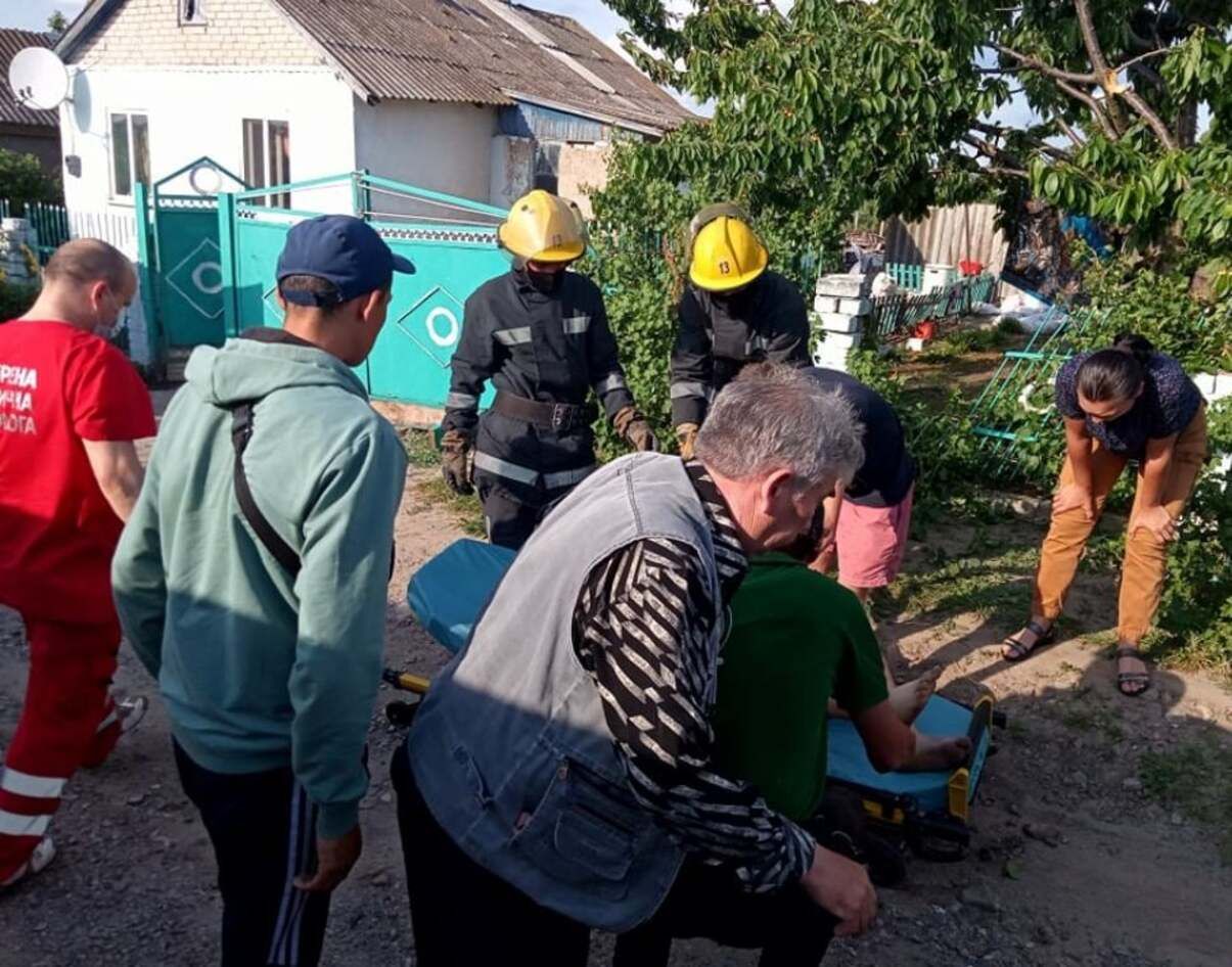 На Херсонщине мальчик упал с дерева и накололся на металлический штырь На Херсонщине мальчик упал с дерева и накололся на металлический штырь