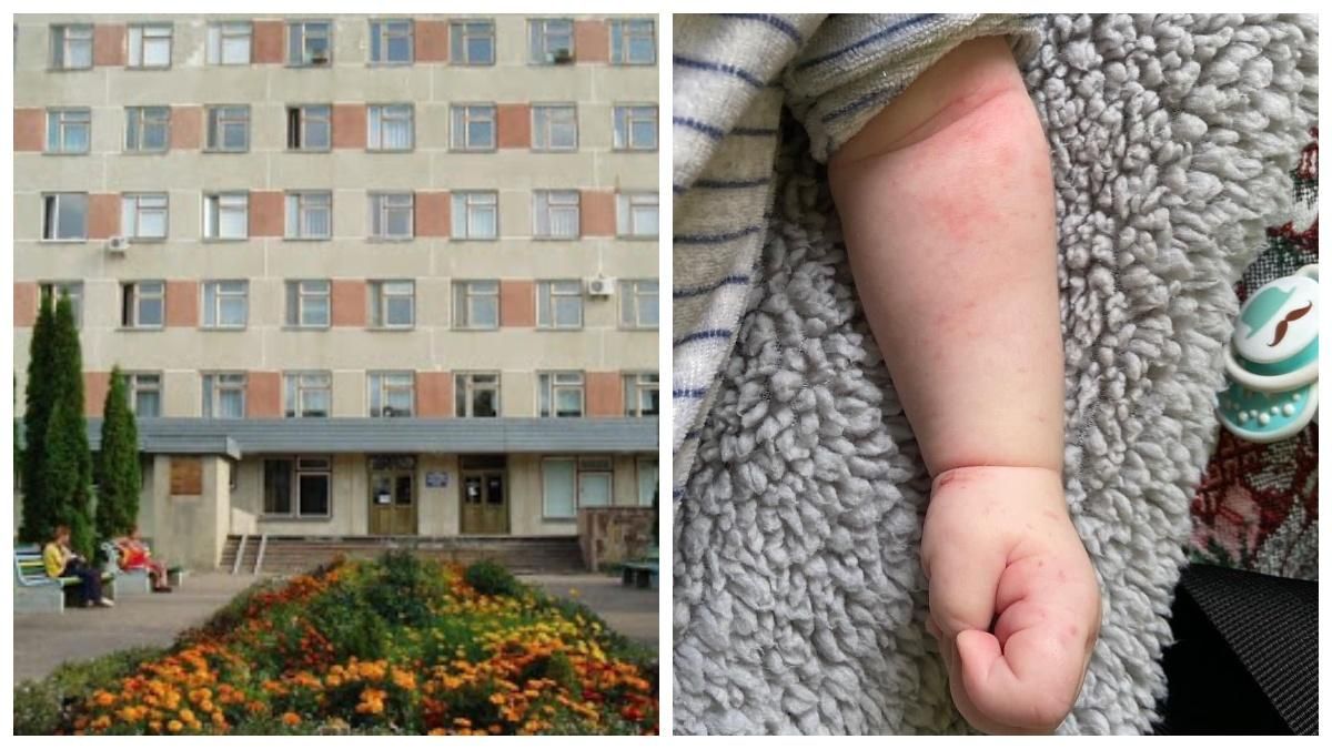 На Житомирщині медики обкололи місячного малюка: фото На Житомирщині медики обкололи місячного малюка: фото