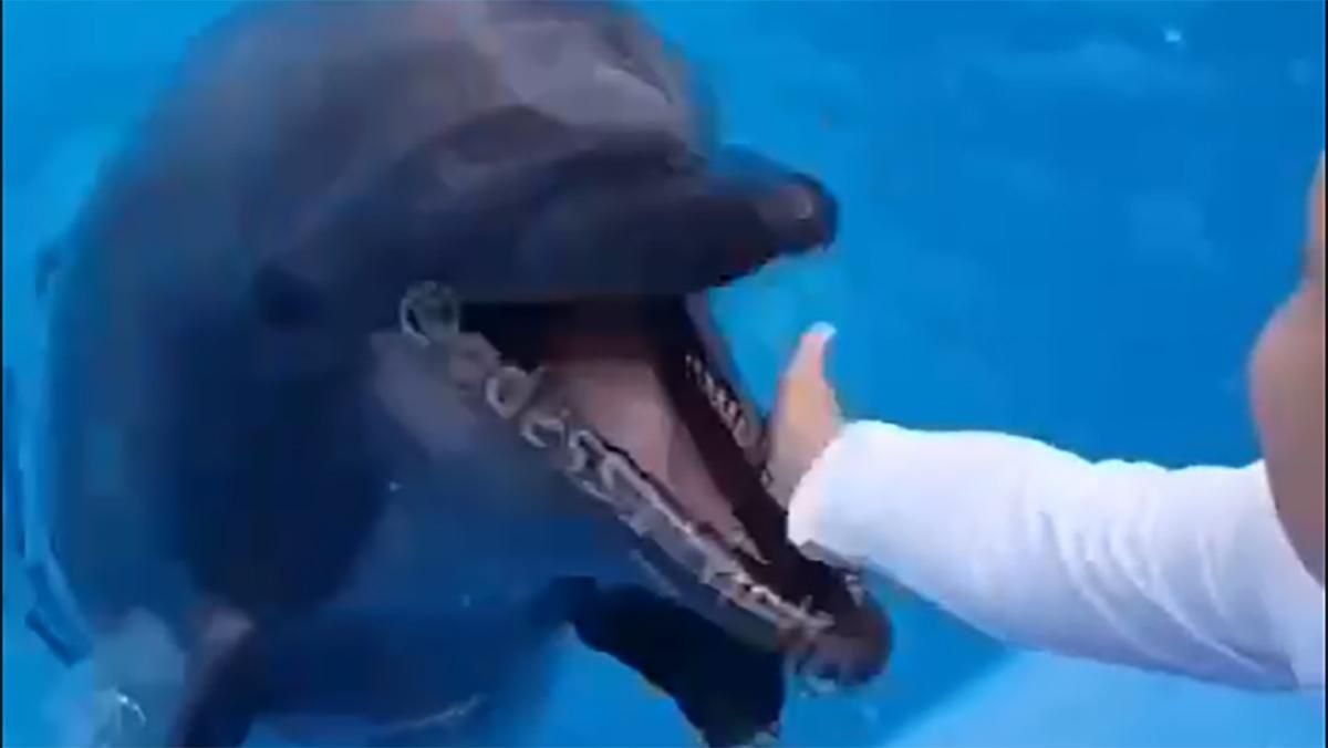 Дельфін вкусив дитину в Одесі: хлопчику наклали шви
