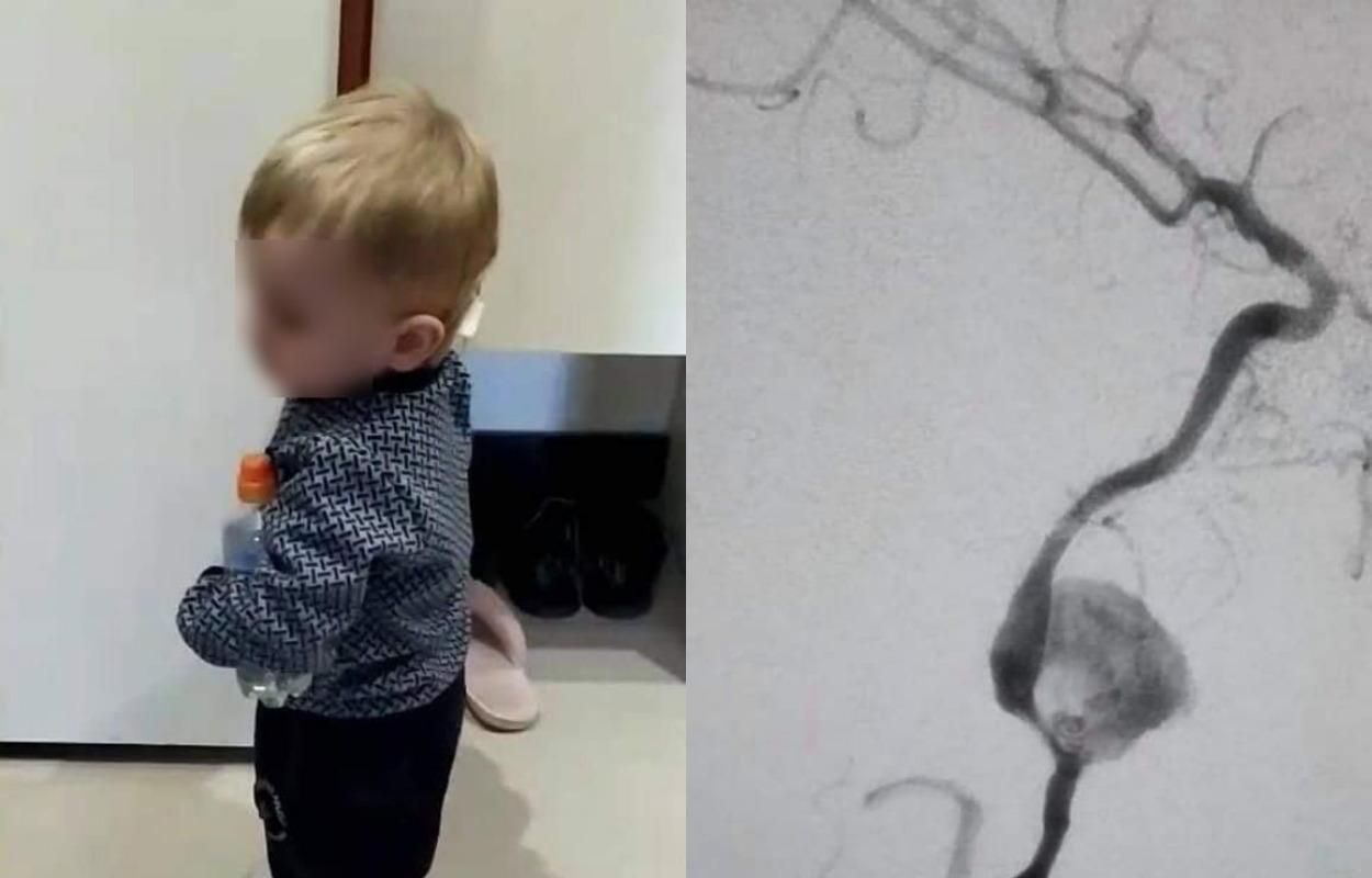 Кров лила фонтаном: у Львові лікарі врятували 1,5-річного хлопчика, який пережив клінічну смерть