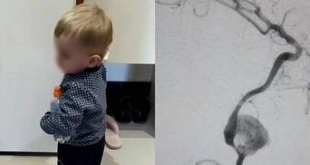 Кровь лила фонтаном: во Львове врачи спасли 1,5-летнего мальчика, пережившего клиническую смерть