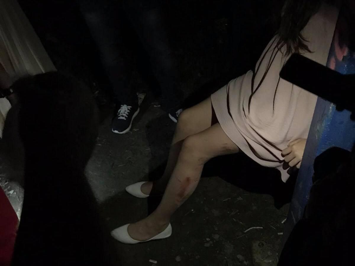 Затисло між бетонними плитами: львівські рятувальники визволили ногу 11-річної дівчинки – фото