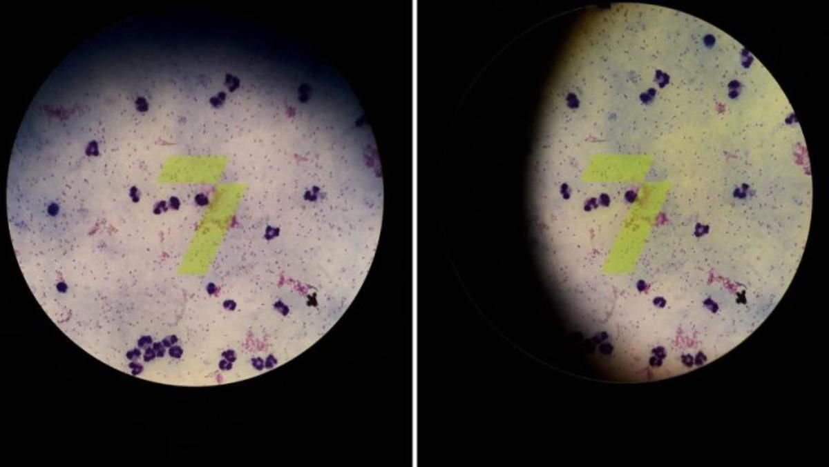 В Одессе моряк заболел малярией: подозревали COVID-19 В Одессе моряк заболел малярией: подозревали COVID-19