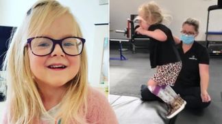 Втратила сестру-близнючку та не мала ходити: мама показала відео з першим стрибком доньки