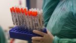 Коронавірус поширюється швидше вакцини, – ООН