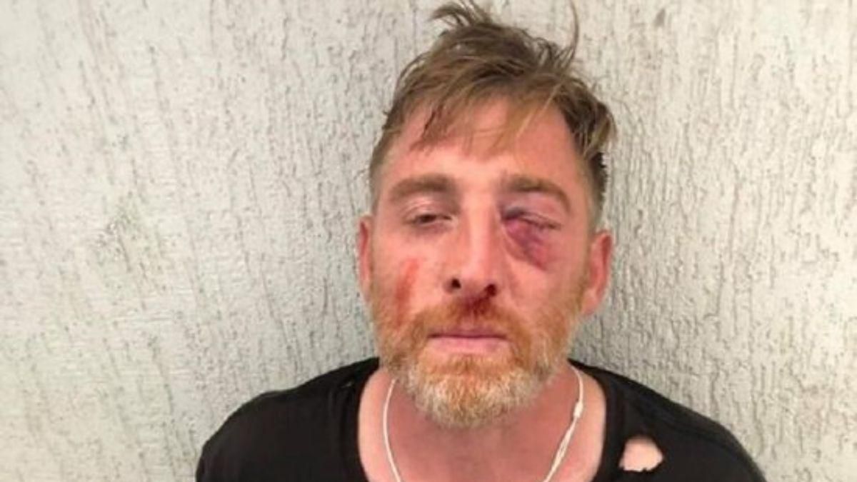 В Грузии скончался журналист, которого избили противники ЛГБТ В Грузии скончался журналист, которого избили противники ЛГБТ