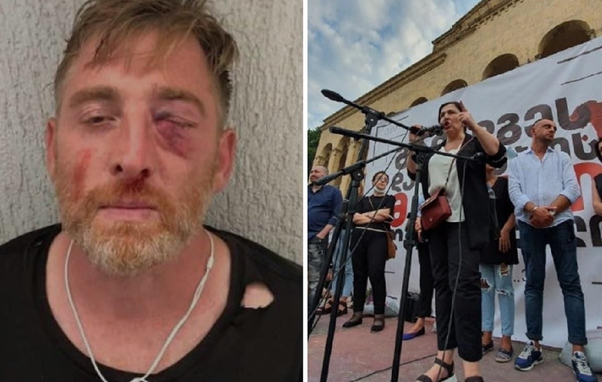 Грузинські ЗМІ звернулися до дипломатів після смерті Лашкарава Грузинські ЗМІ звернулися до дипломатів після смерті Лашкарава