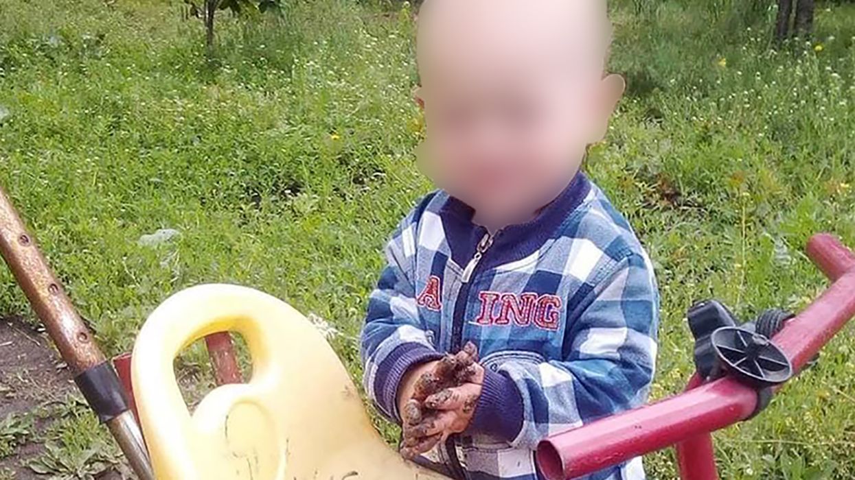 У Дніпрі помер 2-річний хлопчик, якого порізав вітчим У Дніпрі помер 2-річний хлопчик, якого порізав вітчим