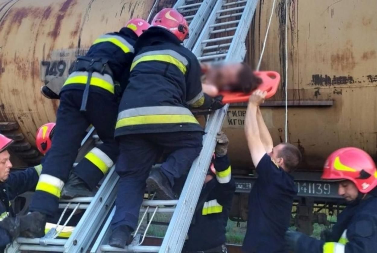 Вразило струмом на цистерні потяга: у Львові оперуватимуть 26-річну жінку з 70% опіків тіла Вразило струмом на цистерні потяга: у Львові оперуватимуть 26-річну жінку з 70% опіків тіла