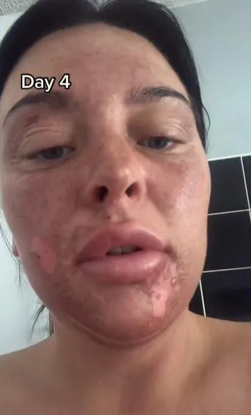 Обличчя Шанталь / Скриншот тікток chantelleconway2020 Обличчя Шанталь / Скриншот тікток chantelleconway2020