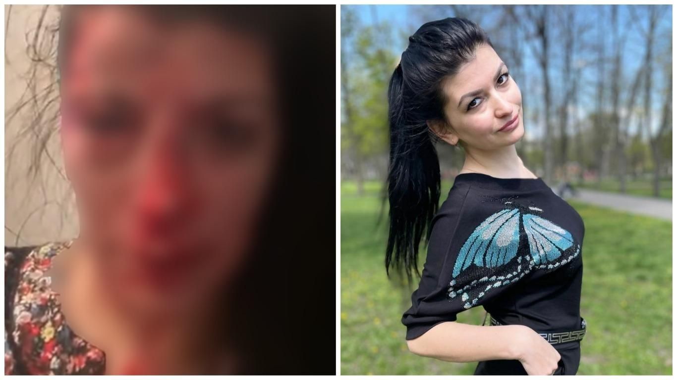 Наталя Ешонкулова побита у Дніпрі: що відомо про напад на активістку